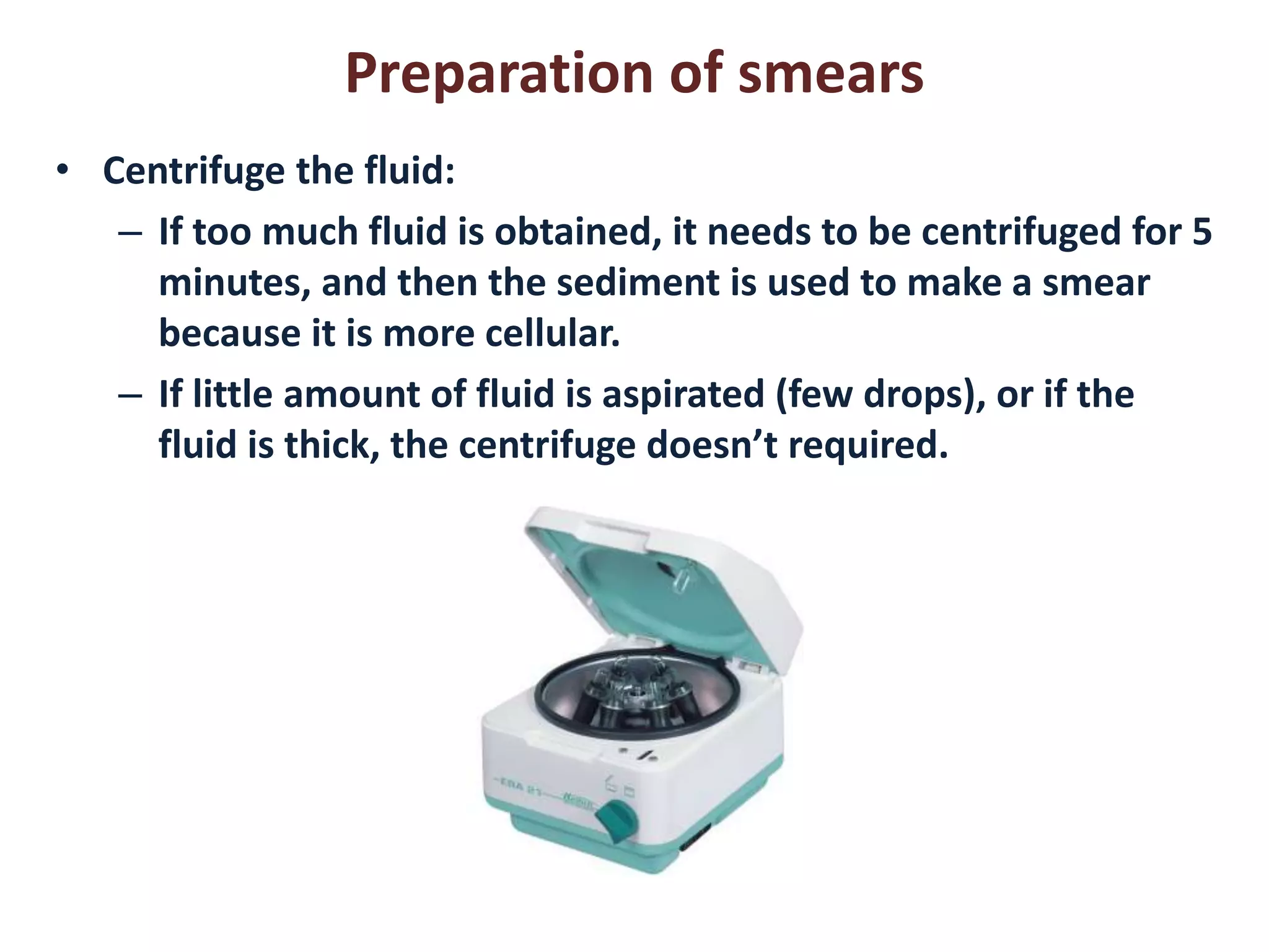 Preparation of smears 
• Centrifuge the fluid: 
– If too much fluid is obtained, it needs to be centrifuged for 5 
minutes, and then the sediment is used to make a smear 
because it is more cellular. 
– If little amount of fluid is aspirated (few drops), or if the 
fluid is thick, the centrifuge doesn’t required. 
 