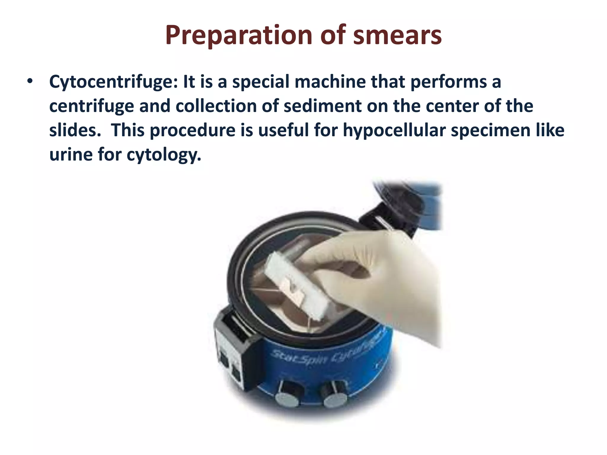 Preparation of smears 
• Cytocentrifuge: It is a special machine that performs a 
centrifuge and collection of sediment on the center of the 
slides. This procedure is useful for hypocellular specimen like 
urine for cytology. 
 