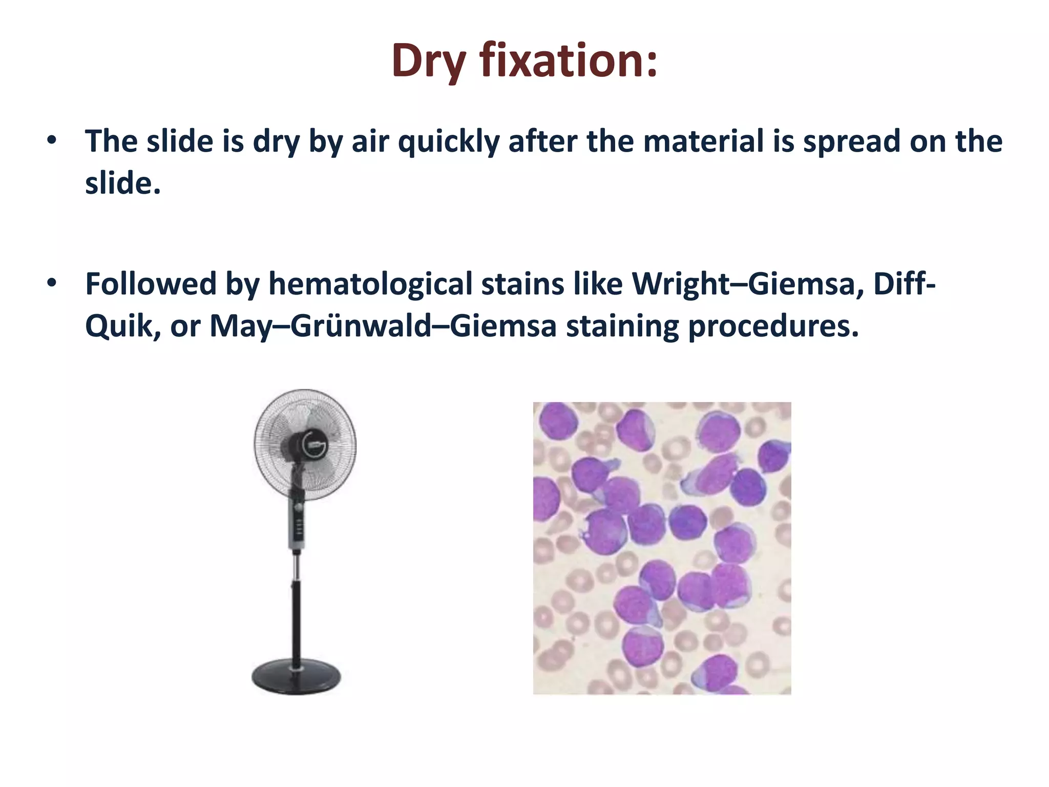 Dry fixation: 
• The slide is dry by air quickly after the material is spread on the 
slide. 
• Followed by hematological stains like Wright–Giemsa, Diff- 
Quik, or May–Grünwald–Giemsa staining procedures. 
 