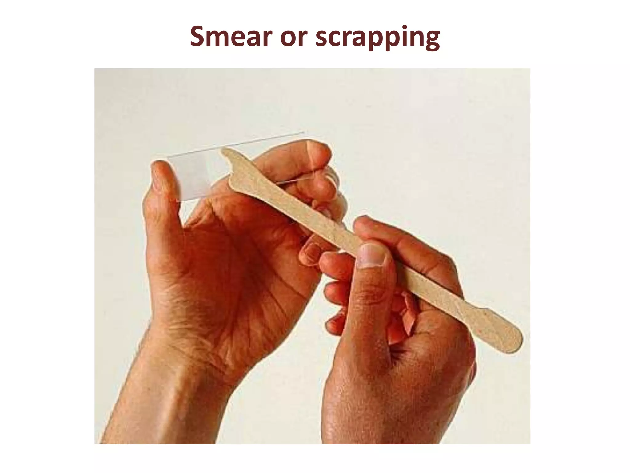 Smear or scrapping 
 