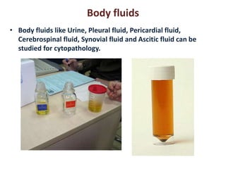 Body fluids 
• Body fluids like Urine, Pleural fluid, Pericardial fluid, 
Cerebrospinal fluid, Synovial fluid and Ascitic fluid can be 
studied for cytopathology. 
 
