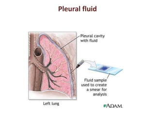 Pleural fluid 
 