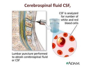 Cerebrospinal fluid CSF, 
 