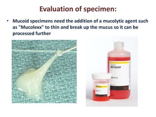 Evaluation of specimen: 
• Mucoid specimens need the addition of a mucolytic agent such 
as "Mucolexx" to thin and break up the mucus so it can be 
processed further 
 