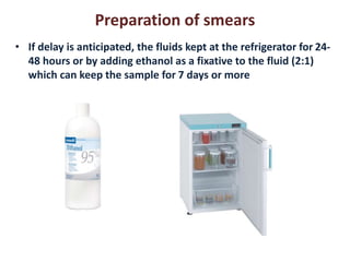 Preparation of smears 
• If delay is anticipated, the fluids kept at the refrigerator for 24- 
48 hours or by adding ethanol as a fixative to the fluid (2:1) 
which can keep the sample for 7 days or more 
 