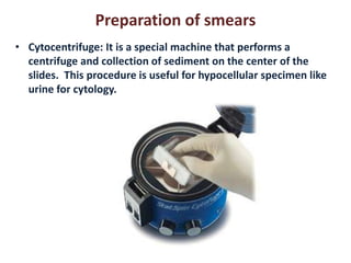 Preparation of smears 
• Cytocentrifuge: It is a special machine that performs a 
centrifuge and collection of sediment on the center of the 
slides. This procedure is useful for hypocellular specimen like 
urine for cytology. 
 