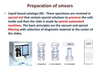 Preparation of smears 
• Liquid based cytology LBC: These specimens are received in 
special vial that contain special solutions to preserve the cells 
inside and then the slide is made by special automated 
machines. The basic principles are the vaccum and special 
filtering with collection of diagnostic material at the center of 
the slides. 
 