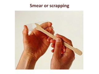 Smear or scrapping 
 