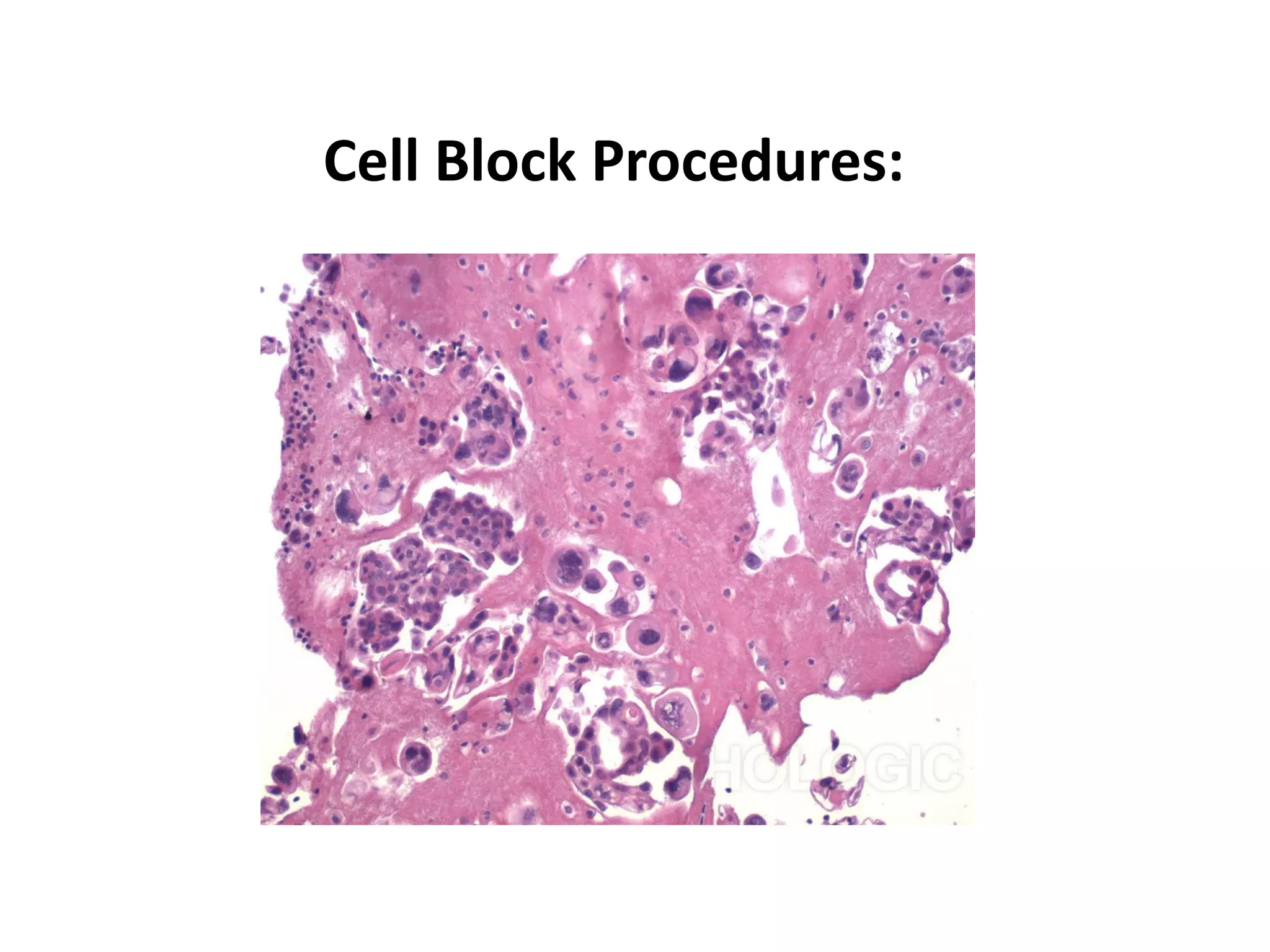 Cell Block Procedures:  