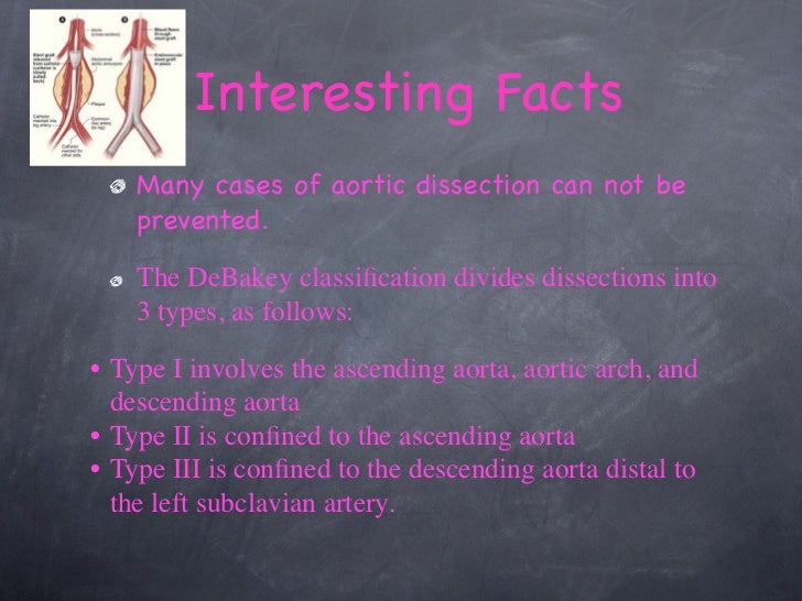 Health slide show aortic dissection type a and b