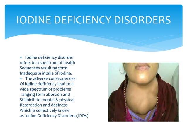 Health talk on iodine deficiency | PPTX