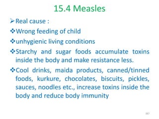 15.4 Measles
Real cause :
Wrong feeding of child
unhygienic living conditions
Starchy and sugar foods accumulate toxins
inside the body and make resistance less.
Cool drinks, maida products, canned/tinned
foods, kurkure, chocolates, biscuits, pickles,
sauces, noodles etc., increase toxins inside the
body and reduce body immunity
387
 
