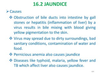 16.2 JAUNDICE
Causes
 Obstruction of bile ducts into intestine by gall
stones or hepatitis (inflammation of liver) by a
virus results in bile mixing with blood giving
yellow pigmentation to the skin.
 Virus may spread due to dirty surroundings, bad
sanitary conditions, contamination of water and
food.
 Pernicious anemia also causes jaundice
 Diseases like typhoid, malaria, yellow fever and
TB which affect liver also causes jaundice.
409
 