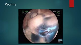 Worms
 