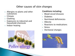 Other causes of skin changes
   Allergies to plants and other   Conditions including:
    substances                       Blood vessel diseases
   Climate                          Diabetes
   Clothing                         Nutritional deficiencies
   Exposures to industrial and      Obesity
    household chemicals
                                     Reactions to medications
   Indoor heating
                                     Stress

                                     Hormonal changes
 
