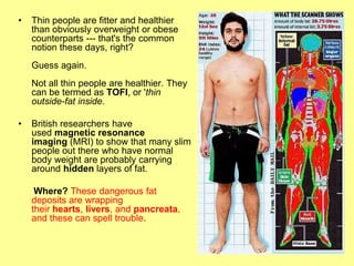•   Thin people are fitter and healthier
    than obviously overweight or obese
    counterparts --- that's the common
    notion these days, right?
    Guess again.
    Not all thin people are healthier. They
    can be termed as TOFI, or 'thin
    outside-fat inside.

•   British researchers have
    used magnetic resonance
    imaging (MRI) to show that many slim
    people out there who have normal
    body weight are probably carrying
    around hidden layers of fat.

     Where? These dangerous fat
    deposits are wrapping
    their hearts, livers, and pancreata,
    and these can spell trouble.
 