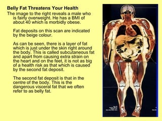 Belly Fat Threatens Your Health
The image to the right reveals a male who
  is fairly overweight. He has a BMI of
  about 40 which is morbidly obese.
  Fat deposits on this scan are indicated
  by the beige colour.
  As can be seen, there is a layer of fat
  which is just under the skin right around
  the body. This is called subcutaneous fat
  and apart from causing extra strain on
  the heart and on the feet, it is not as big
  of a health risk as that which is caused
  by the second fat deposit.
  The second fat deposit is that in the
  centre of the body. This is the
  dangerous visceral fat that we often
  refer to as belly fat.
 