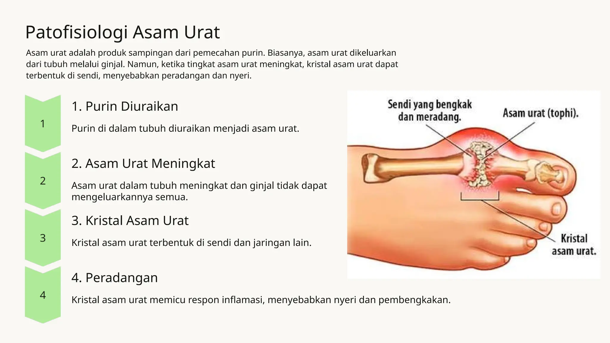 materi presentasi penyakit Asam Urat.pptx