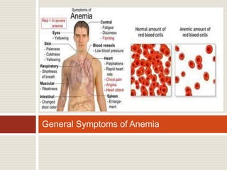 General Symptoms of Anemia
 