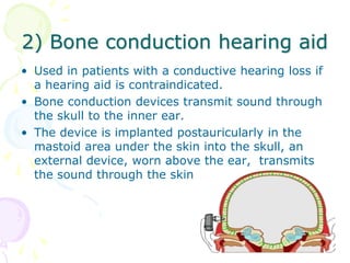2) Bone conduction hearing aid
• Used in patients with a conductive hearing loss if
a hearing aid is contraindicated.
• Bone conduction devices transmit sound through
the skull to the inner ear.
• The device is implanted postauricularly in the
mastoid area under the skin into the skull, an
external device, worn above the ear, transmits
the sound through the skin
 