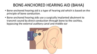 BONE-ANCHORED HEARING AID (BAHA)
• Bone-anchored hearing aid is a type of hearing aid which is based on the
principle of bone conduction.
• Bone-anchored hearing aids use a surgically implanted abutment to
transmit sound by direct conduction through bone to the cochlea,
bypassing the external auditory canal and middle ear
 