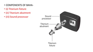 • COMPONENTS OF BAHA-
• (i) Titanium fixture
• (ii) Titanium abutment
• (iii) Sound processor
 