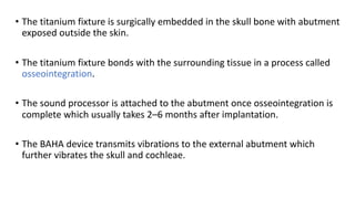 • The titanium fixture is surgically embedded in the skull bone with abutment
exposed outside the skin.
• The titanium fixture bonds with the surrounding tissue in a process called
osseointegration.
• The sound processor is attached to the abutment once osseointegration is
complete which usually takes 2–6 months after implantation.
• The BAHA device transmits vibrations to the external abutment which
further vibrates the skull and cochleae.
 