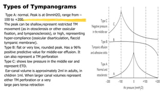Typanogram Types Normal Hearing assesment in children.pptx