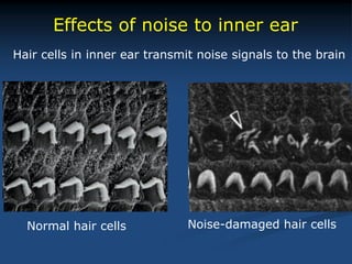 Effects of noise to inner ear
Normal hair cells Noise-damaged hair cells
Hair cells in inner ear transmit noise signals to the brain
 