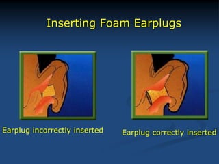 Inserting Foam Earplugs
Earplug incorrectly inserted Earplug correctly inserted
 