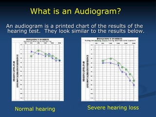 An audiogram is a printed chart of the results of the
hearing test. They look similar to the results below.
What is an Audiogram?
Normal hearing Severe hearing loss
 