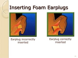 Inserting Foam Earplugs   Earplug incorrectly inserted Earplug correctly inserted 