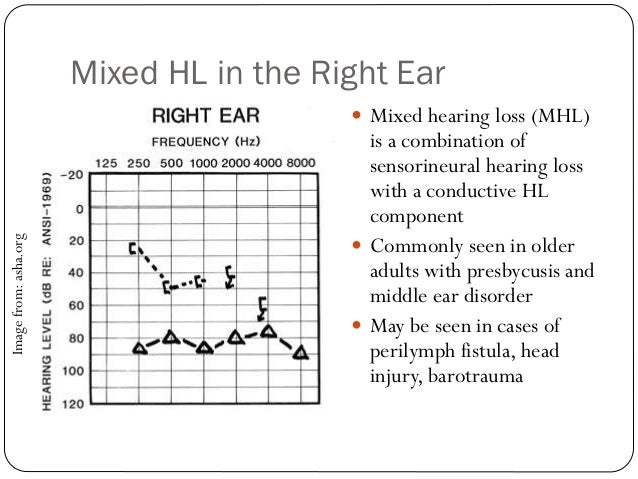 Hearing Disorders Review