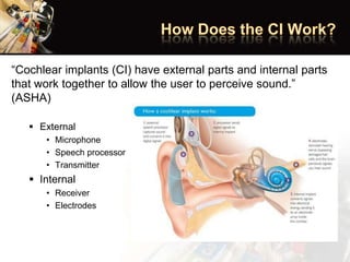“Cochlear implants (CI) have external parts and internal parts
that work together to allow the user to perceive sound.”
(ASHA)
 External
• Microphone
• Speech processor
• Transmitter
 Internal
• Receiver
• Electrodes
 