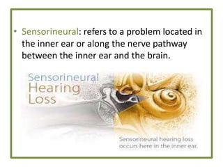 • Sensorineural: refers to a problem located in
the inner ear or along the nerve pathway
between the inner ear and the brain.
 