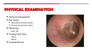 PHYSICAL EXAMINATIONPHYSICAL EXAMINATION
 General assessment
 Ear exam:
 Deformities of Pinna & EAC
 Pre & post-auricular region
 Otoscopy
- EAC, TM
 Tuning Fork Test
- Rinne
- Weber
 Cranial Nerves
 
