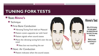 TUNING FORKTESTSTUNING FORKTESTS
Test: Rinne’s
 Technique
 First: Bone Conduction
 VibratingTuning Fork held on Mastoid
 Patient covers opposite ear with hand
 Patient signals when sound ceases
 Move the vibrating tuning fork over the ear
canal
 Near, but not touching the ear
 Next: Air Conduction
 Patient indicates when the sound ceases
 