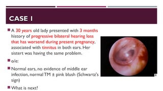 CASE 1CASE 1
A 30 years old lady presented with 3 months
history of progressive bilateral hearing loss
that has worsend during present pregnancy,
associated with tinnitus in both ears. Her
sistert was having the same problem.
o/e:
Normal ears, no evidence of middle ear
infection, normal TM ± pink blush (Schwartz's
sign)
What is next?
 