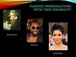 FAMOUS PERSONALITIES
WITH THIS DISABILITY

Beethoven

Will I am

Halle Barry

 