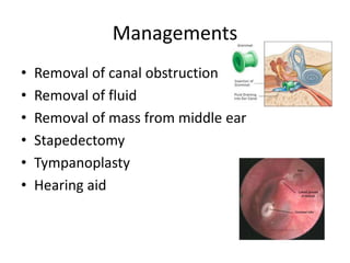 Managements
• Removal of canal obstruction
• Removal of fluid
• Removal of mass from middle ear
• Stapedectomy
• Tympanoplasty
• Hearing aid
 