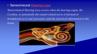 Hearing loss | PPTX