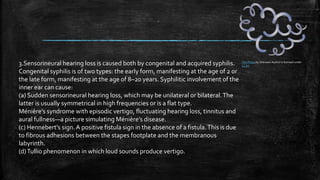 Hearing loss | PPTX