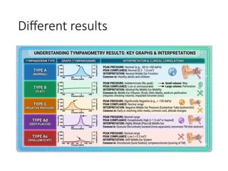 Tympanometry Graph Types Understanding Hearing Loss Through Tympanometry and Tympanogram ...