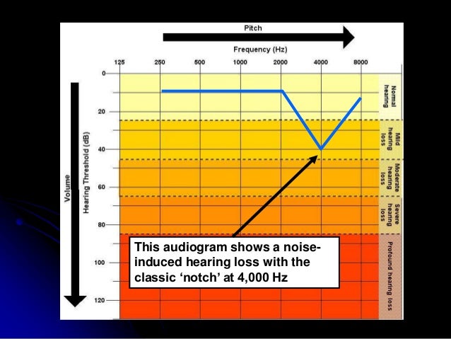 hearing loss amp speech sounds noise induced hearing loss