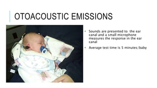OTOACOUSTIC EMISSIONS
 Sounds are presented to the ear
canal and a small microphone
measures the response in the ear
canal
 Average test time is 5 minutes/baby
 
