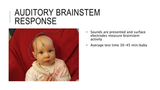 AUDITORY BRAINSTEM
RESPONSE
 Sounds are presented and surface
electrodes measure brainstem
activity
 Average test time 30-45 min/baby
 