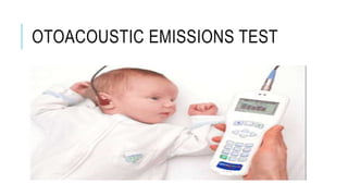 OTOACOUSTIC EMISSIONS TEST
 