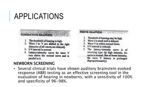 APPLICATIONS
NEWBORN SCREENING
• Several clinical trials have shown auditory brainstem evoked
response (ABR) testing as an effective screening tool in the
evaluation of hearing in newborns, with a sensitivity of 100%
and specificity of 96-98%.
 