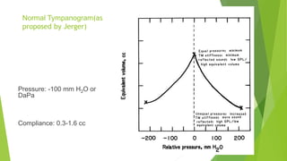 Normal Tympanogram(as
proposed by Jerger)
Pressure: -100 mm H2O or
DaPa
Compliance: 0.3-1.6 cc
 