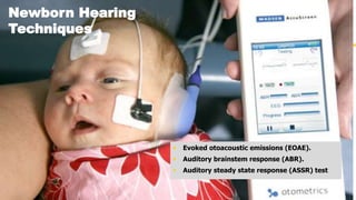 Hearing Tests for Children | PPTX